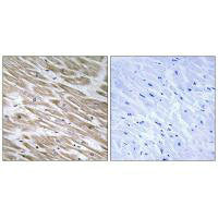 Immunohistochemistry analysis of paraffin-embedded human heart tissue using KANK2 antibody.