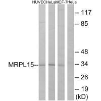 Western blot analysis of extracts from HUVEC cells, HeLa cells and MCF-7cells, using MRPL15 antibody.