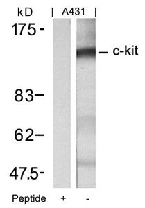 Western blot analysis of extracts from A431 cells using c-Kit(Ab-721) Antibody and the same antibody preincubated with blocking peptide.