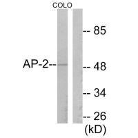 Western blot analysis of extracts from COLO205 cells, using AP-2 antibody.