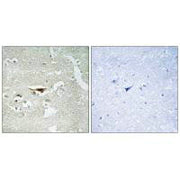 Immunohistochemistry analysis of paraffin-embedded human brain tissue, using IPKB antibody.