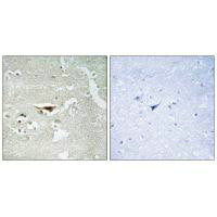 Immunohistochemistry analysis of paraffin-embedded human brain tissue, using IPKB antibody.