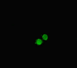 Immunofluorescent analysis of HepG2 cells using CSB-PA17907A0Rb at dilution of 1:100 and Alexa Fluor 488-congugated AffiniPure Goat Anti-Rabbit IgG(H+L)