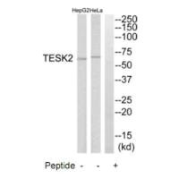 Western blot analysis of extracts from HepG2 cells and HeLa cells, using TESK2 antibody.