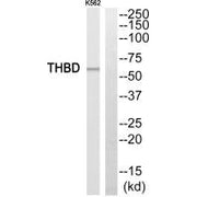 Western blot analysis of extracts from K562 cells, using THBD antibody.