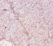 Immunohistochemistry of paraffin-embedded human tonsil tissue using CSB-PA17939A0Rb at dilution of 1:20