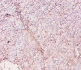 Immunohistochemistry of paraffin-embedded human tonsil tissue using CSB-PA17939A0Rb at dilution of 1:20