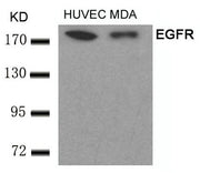 Western blot analysis of extracts from HUVEC and MDA cells using EGFR(Ab-693) Antibody.