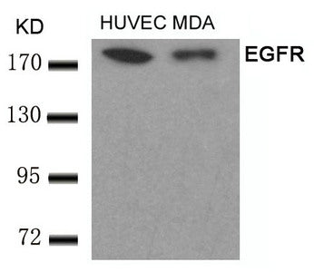 Western blot analysis of extracts from HUVEC and MDA cells using EGFR(Ab-693) Antibody.