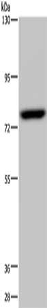 Gel: 6%SDS-PAGE, Lysate: 40 ug, Lane: PC3 cells, Primary antibody: CSB-PA179677(NR4A1 Antibody) at dilution 1/200, Secondary antibody: Goat anti rabbit IgG at 1/8000 dilution, Exposure time: 5 minutes