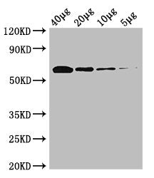 Western Blot Positive WB detected in: Rosseta bacteria lysate at 40µg, 20µg, 10µg, 5µg All lanes: poxB antibody at 0.25µg/ml Secondary Goat polyclonal to rabbit IgG at 1/50000 dilution Predicted band size: 63 kDa Observed band size: 63 kDa