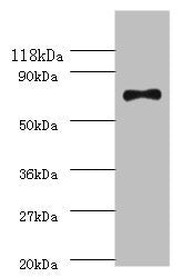 Western blot All lanes: ATP-dependent DNA helicase RecQ antibody at 2ug/ml + DH5a whole cell lysate Secondary Goat polyclonal to rabbit IgG at 1/10000 dilution Predicted band size: 68 kDa Observed band size: 68 kDa