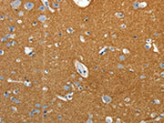 The image on the left is immunohistochemistry of paraffin-embedded Human brain tissue using CSB-PA180041(SSTR4 Antibody) at dilution 1/25, on the right is treated with synthetic peptide. (Original magnification: ×200)