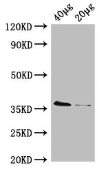Western Blot Positive WB detected in: Rosseta bacteria lysate at 40µg, 20µg All lanes: dcyD antibody; HRP conjugated at 0.42µg/ml Predicted band size: 36 kDa Observed band size: 36 kDa