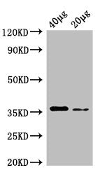 Western Blot Positive WB detected in: Rosseta bacteria lysate at 40µg, 20µg All lanes: dcyD antibody at 0.25µg/ml Secondary Goat polyclonal to rabbit IgG at 1/50000 dilution Predicted band size: 36 kDa Observed band size: 36 kDa