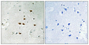 Immunohistochemical analysis of paraffin-embedded human brain tissue using ITCH (Phospho-Tyr420) antibody (left)or the same antibody preincubated with blocking peptide (right).