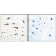 Immunohistochemical analysis of paraffin-embedded human brain tissue using GluR6 antibody.