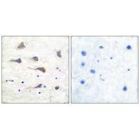 Immunohistochemical analysis of paraffin-embedded human brain tissue using GluR6 antibody.