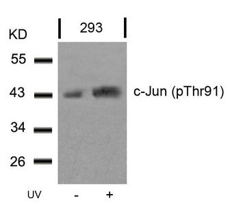 Western blot analysis of extracts from 293 cells untreated or treated with UV using c-Jun(Phospho-Thr91) Antibody.