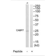 Western blot analysis of extracts from Jurkat cells, using CABP7 antibody.