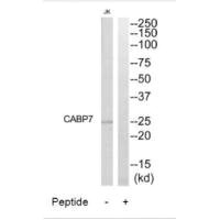 Western blot analysis of extracts from Jurkat cells, using CABP7 antibody.