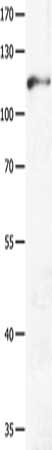 Gel: 8%SDS-PAGE, Lysate: 40 ug, Lane: Mouse brain tissue, Primary antibody: CSB-PA180654(GRM3 Antibody) at dilution 1/250, Secondary antibody: Goat anti rabbit IgG at 1/8000 dilution, Exposure time: 2 minutes
