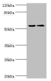 Western blot All lanes: CASP8 antibody at 2µg/ml Lane 1: ACCM whole cell lysate Lane 2: LO2 whole cell lysate Secondary Goat polyclonal to rabbit IgG at 1/10000 dilution Predicted band size: 56, 54, 46, 58, 28, 26, 33, 31, 62 kDa Observed band siz...
