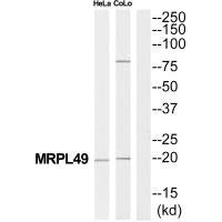 Western blot analysis of extracts from HeLa/COLO205 cells, using MRPL49 antibody.