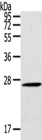 Gel: 10%SDS-PAGE,Lysate: 40 ug,,Primary antibody: CSB-PA181586(CLEC4A Antibody) at dilution 1/100 dilution,Secondary antibody: Goat anti rabbit IgG at 1/8000 dilution,Exposure time: 1 minute