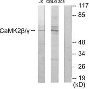 Western blot analysis of extracts from Jurkat cells and COLO205 cells, using CaMK2β/γ antibody.