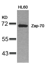 Western blot analysis of extracts from HL60 cells using Zap-70(Ab-319) Antibody.