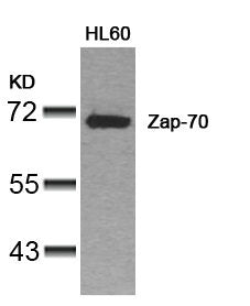 Western blot analysis of extracts from HL60 cells using Zap-70(Ab-319) Antibody.