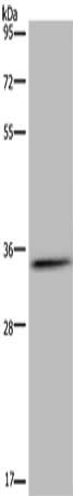 Gel: 8%SDS-PAGE, Lysate: 40 ug, Lane: Human testis tissue, Primary antibody: CSB-PA181933(HSD17B7 Antibody) at dilution 1/200, Secondary antibody: Goat anti rabbit IgG at 1/8000 dilution, Exposure time: 10 minutes