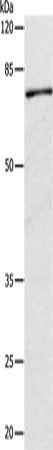 Gel: 10%SDS-PAGE, Lysate: 30 ug, Lane: Human fetal kidney tissue, Primary antibody: CSB-PA182064(CAPN1 Antibody) at dilution 1/500, Secondary antibody: Goat anti rabbit IgG at 1/8000 dilution, Exposure time: 1 minute