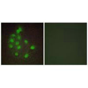 Immunofluorescence analysis of A549 cells, using HAND1 antibody.