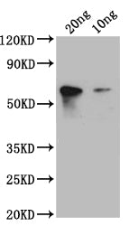 Western Blot Positive WB detected in: recombinant protein All lanes: S1 Antibody at 1:1000 Secondary Goat polyclonal to rabbit IgG at 1/50000 dilution Predicted band size: 45 kDa Observed band size: 45 kDa