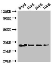 Western Blot Positive WB detected in: Rosseta bacteria lysate at 80ug, 40ug, 20ug, 10ug All lanes: eutC antibody at 3ug/ml Secondary Goat polyclonal to rabbit IgG at 1/50000 dilution predicted band size: 32 kDa observed band size: 32 kDa