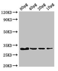 Western Blot Positive WB detected in: Rosseta bacteria lysate at 80ug, 40ug, 20ug, 10ug All lanes: eutC antibody at 3ug/ml Secondary Goat polyclonal to rabbit IgG at 1/50000 dilution predicted band size: 32 kDa observed band size: 32 kDa