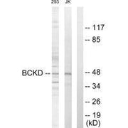 Western blot analysis of extracts from 293 cells and Jurkat cells, using BCKD antibody.