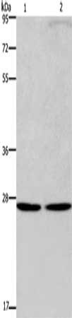Gel: 8%SDS-PAGE, Lysate: 40 ug, Lane 1-2: A375 cells, Hela cells, Primary antibody: CSB-PA183025(EIF6 Antibody) at dilution 1/200, Secondary antibody: Goat anti rabbit IgG at 1/8000 dilution, Exposure time: 10 minutes