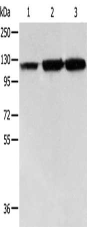 Gel: 8%SDS-PAGE, Lysate: 40 ug, Lane 1-3: PC3 cells, human colon cancer tissue, Human liver cancer tissue, Primary antibody: CSB-PA183277(HSPH1 Antibody) at dilution 1/500, Secondary antibody: Goat anti rabbit IgG at 1/8000 dilution, Exposure time...