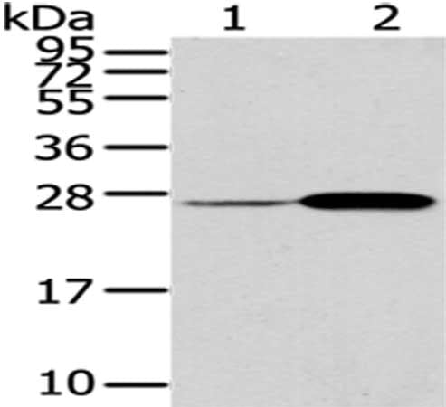 Gel: 12%SDS-PAGE, Lysate: 40 ug, Lane 1-2: Mouse lung and bladder tissue, Primary antibody: CSB-PA183306(CD79A Antibody) at dilution 1/200 dilution, Secondary antibody: Goat anti rabbit IgG at 1/8000 dilution, Exposure time: 1 minute
