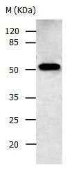 Gel: 10%SDS-PAGE Lysate: 30 ug Human fetal brain tissue lysate Primary antibody: 1/500 dilution Secondary antibody: Donkey anti Rabbit IgG - H&L (HRP) at 1/3000 dilution Exposure time: 30 seconds