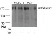 Western blot analysis of extracts from PMA-treated HUVEC cells or EGF-treated MDA cells using EGFR(phospho-Tyr1197) goat polyclonal antibody.