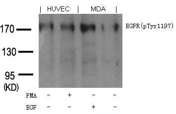 Western blot analysis of extracts from PMA-treated HUVEC cells or EGF-treated MDA cells using EGFR(phospho-Tyr1197) goat polyclonal antibody.