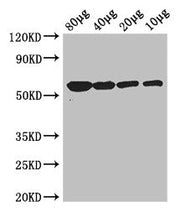 Western Blot Positive WB detected in: Rosseta bacteria lysate at 80µg, 40µg, 20µg, 10µg All lanes: glpK antibody at 3µg/ml Secondary Goat polyclonal to rabbit IgG at 1/50000 dilution Predicted band size: 57 kDa Observed band size: 57 kDa