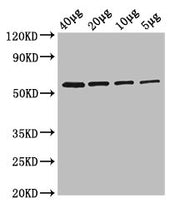 Western Blot Positive WB detected in: Rosseta bacteria lysate at 40µg, 20µg, 10µg, 5µg All lanes: glpK antibody at 2.5µg/ml Secondary Goat polyclonal to rabbit IgG at 1/50000 dilution Predicted band size: 57 kDa Observed band size: 57 kDa