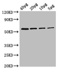 Western Blot Positive WB detected in: Rosseta bacteria lysate at 40µg, 20µg, 10µg, 5µg All lanes: glpK antibody at 2.5µg/ml Secondary Goat polyclonal to rabbit IgG at 1/50000 dilution Predicted band size: 57 kDa Observed band size: 57 kDa
