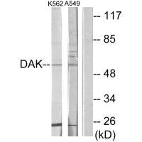 Western blot analysis of extracts from K562 cells and A549 cells, using DAK antibody.