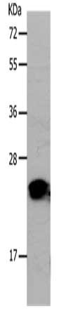 Gel: 10%SDS-PAGE, Lysate: 30 ug, Lane: Human liver cancer tissue, Primary antibody: CSB-PA184823(PONC Antibody) at dilution 1/1200, Secondary antibody: Goat anti rabbit IgG at 1/8000 dilution, Exposure time: 1 second